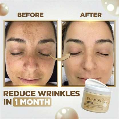 Whitening And Dark Spot Treatment Cream